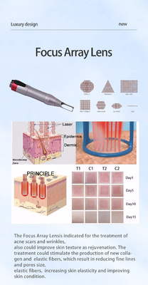 Todo en un Picosecond Laser depilación y ND YAG Laser de la máquina de eliminación de tatuajes