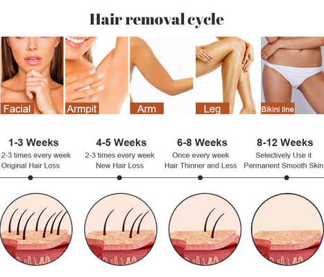 Salón de belleza IPL Máquina láser de depilación de pelo RF cuidado de la piel Eliminación de tatuajes