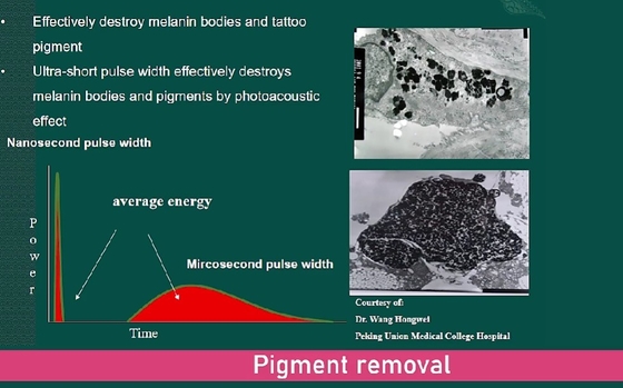Máquina láser YAG de picosegundos comercial 3500W dispositivo de eliminación de tatuajes láser indoloro