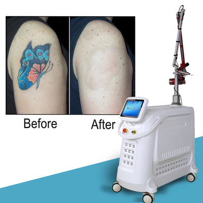 Máquina láser de picosegundos de estilo estacionario 2000W Q conmutada Nd YAG Máquina de eliminación de tatuajes con láser