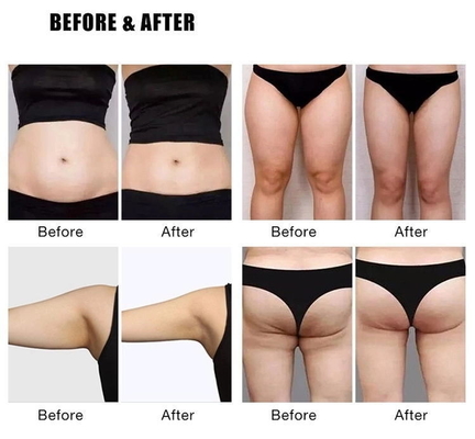 Máquina para bajar de peso EMS Slim 4000W Electromagnética para adelgazar el cuerpo Máquina para esculpir EMS