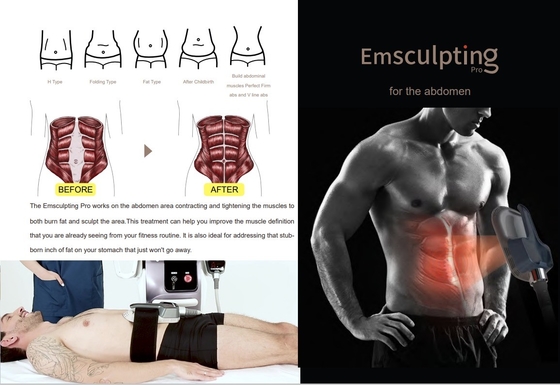 Máquina de adelgazamiento comercial EMS de 10 pulgadas con pantalla táctil para salón de belleza / spa