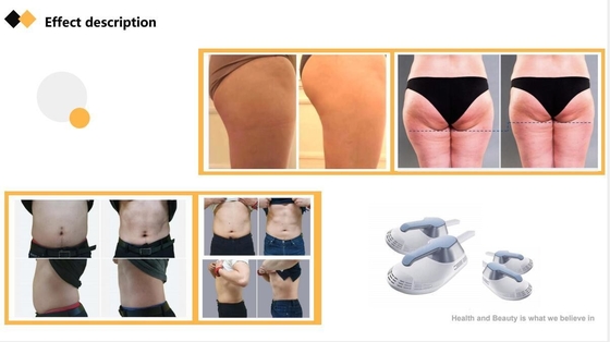 Máquina de escultura corporal ABS EMS Estimulador muscular eléctrico EMS comercial