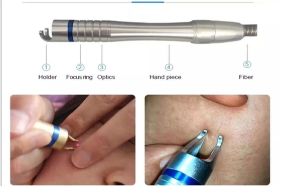 Máquina de extracción vascular con láser de 15W 30W para tratamiento de uñas / rejuvenecimiento de la piel con láser caliente