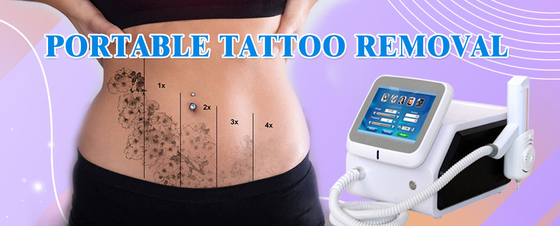 Máquina de depilación médica Nd YAG 1064nm 532nm Equipo de eliminación de tatuajes con láser