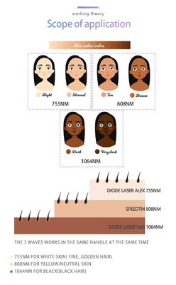 4 en 1 Máquina de depilación láser de belleza multifuncional para uso comercial
